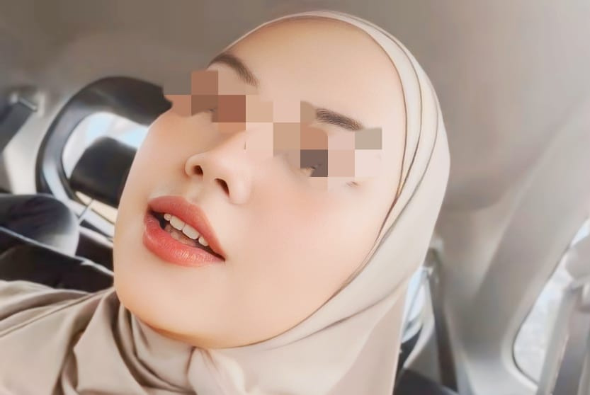 Mendiang korban Marifatul Ainiyah 24 tahun asal Lumajang semasa hidup yang dibunuh kekasihnya Muhammad Ilham 25 tahun, TKP di Hotel Double Tree Hilton Tunjungan, Surabaya.